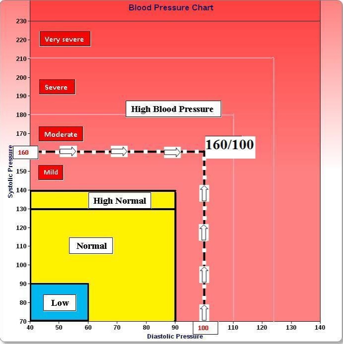 Low Diastolic Blood Pressure Chart